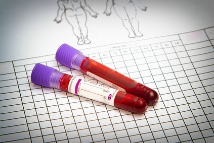 Blood vial with blood sample on record form